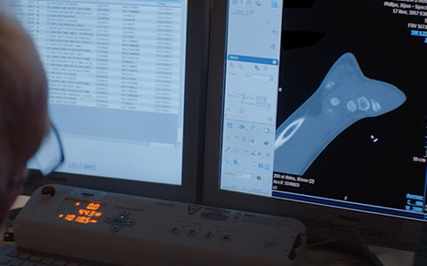 Poprawa komfortu pacjent&oacute;w &mdash; klip wideo