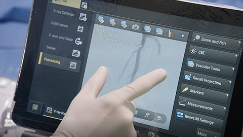 Przedstawiamy nową generację system&oacute;w Azurion firmy Philips do radiologii interwencyjnej