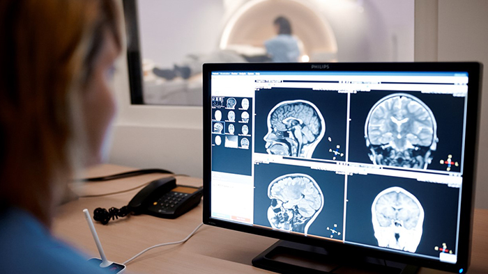 Technik przeglądający tomografię mózgu