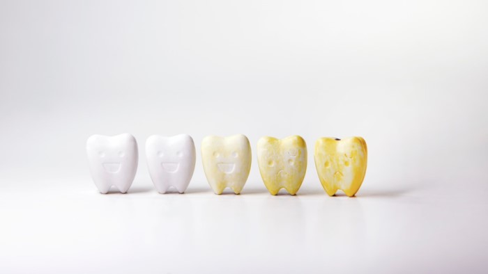 Przebarwienia egzogenne &ndash; przyczyny, rodzaje, profilaktyka