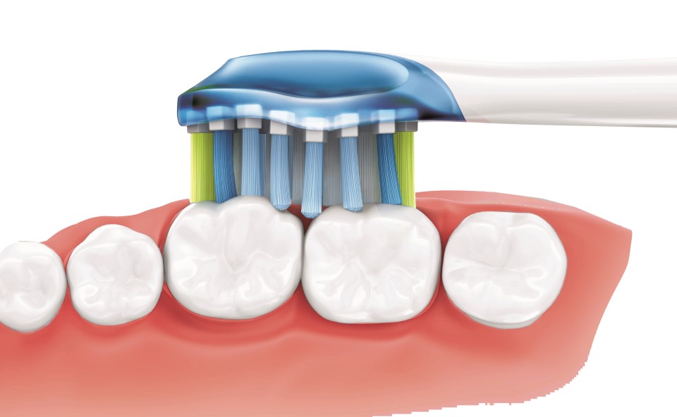 Wyb&oacute;r odpowiedniej szczoteczki to podstawa w pielęgnacji jamy ustnej.